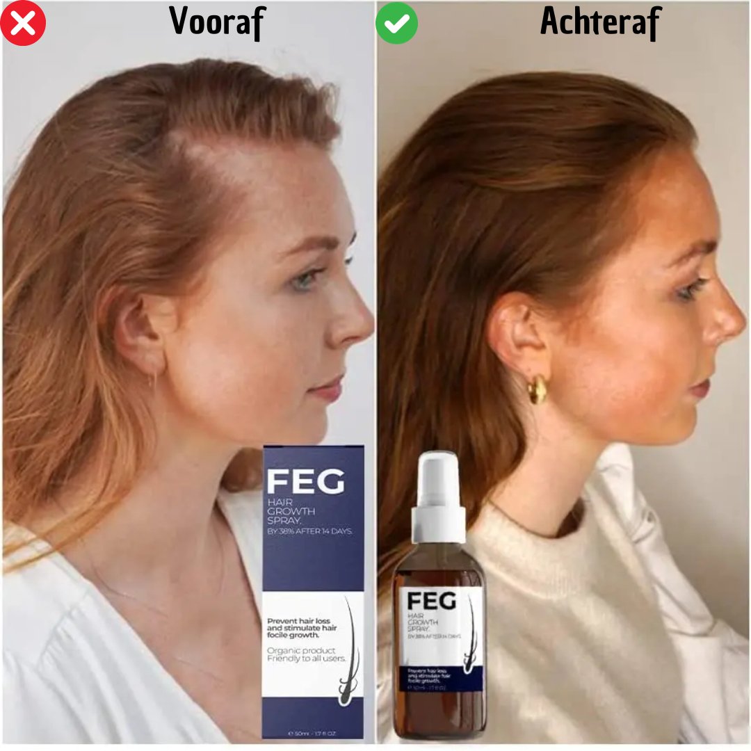 FEG HairVital | 1 + 1 Gratis! - #FEG HairVital | 1 + 1 Gratis!De Bazelaar